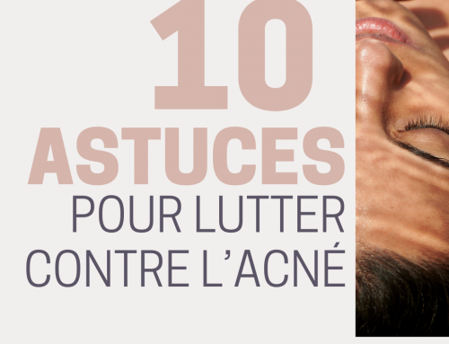 10 astuces pour lutter contre l’acné
